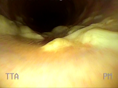 Performance Limiting Respiratory Diseases in Thoroughbreds Image 3