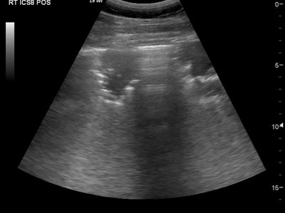 Performance Limiting Respiratory Diseases in Thoroughbreds Image 4