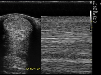 Biologically Derived Therapies for Tendon and Ligament Injur ... Image 3