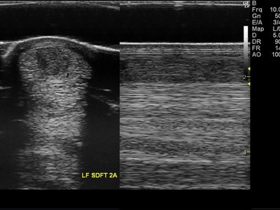 Biologically Derived Therapies for Tendon and Ligament Injur ... Image 4